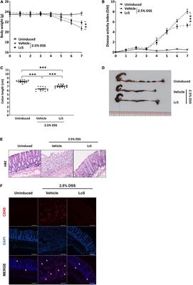 Lactobacillus casei Strain Shirota Ameliorates Dextran Sulfate Sodium-Induced Colitis in Mice by Increasing Taurine-Conjugated Bile Acids and Inhibiting NF-κB Signaling via Stabilization of IκBα